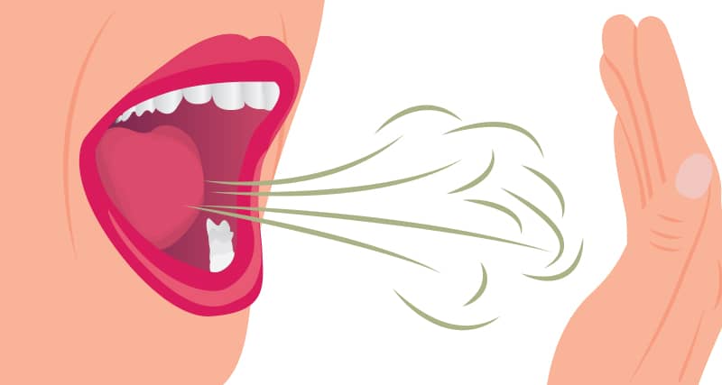 أسباب رائحة الفم الكريهة… من التدخين إلى أمراض الجهازين الهضمي والتنفسي