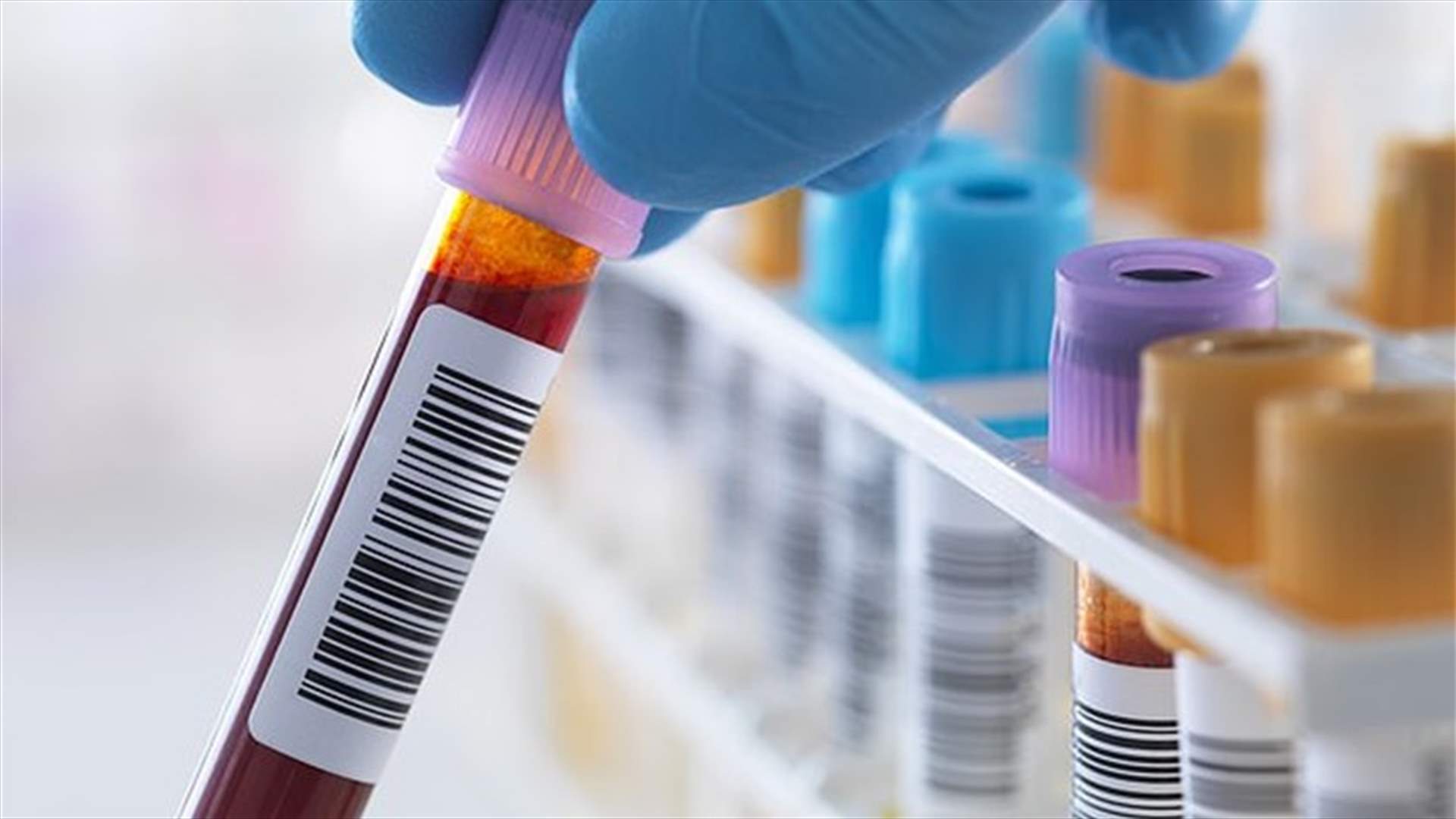 اختبار دم جديد يكتشف أكثر من 50 نوعاً من السرطان بدقة عالية اختبار دم جديد يكتشف أكثر من 50 نوعاً من السرطان بدقة عالية