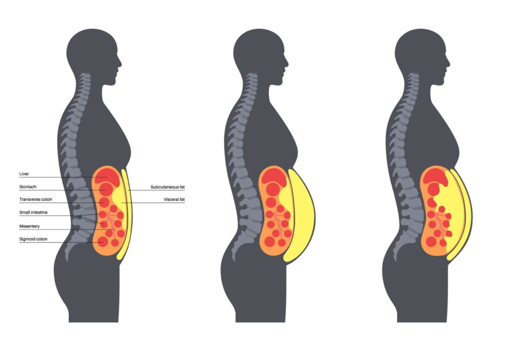 دراسة كندية: دهون خفية حول الأعضاء تهدد الشرايين حتى لدى الأشخاص النحفاء
