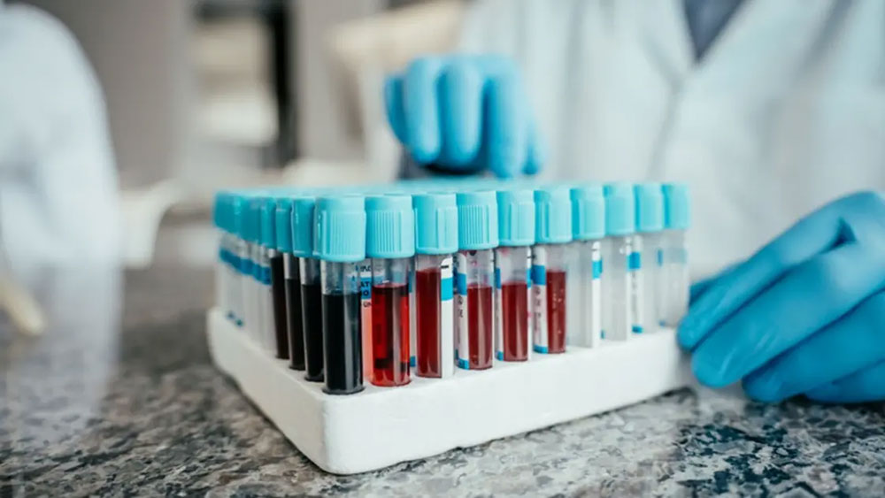 4 فحوصات دم ضرورية بعد سن الأربعين تكشف أمراضًا صامتة