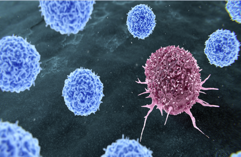 علاج جديد يستخدم الضوء لقتل الخلايا السرطانية دون الإضرار بالأنسجة السليمة