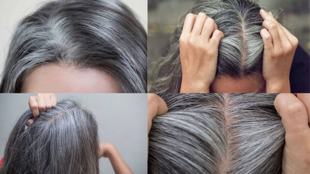 وصفات طبيعية فعالة لعلاج الشيب المبكر واستعادة لون الشعر الطبيعي